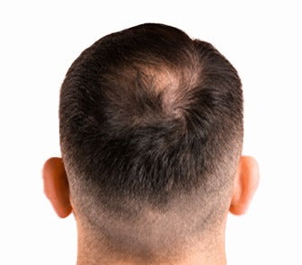 Before using the product