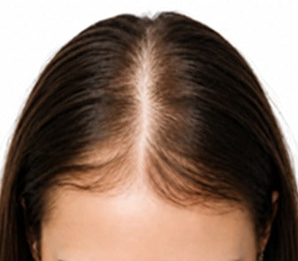Before using the product