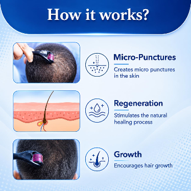 Derma Roller 0.5mm for Hair Growth & Beard Care | 540 Titanium Microneedles Scalp Roller