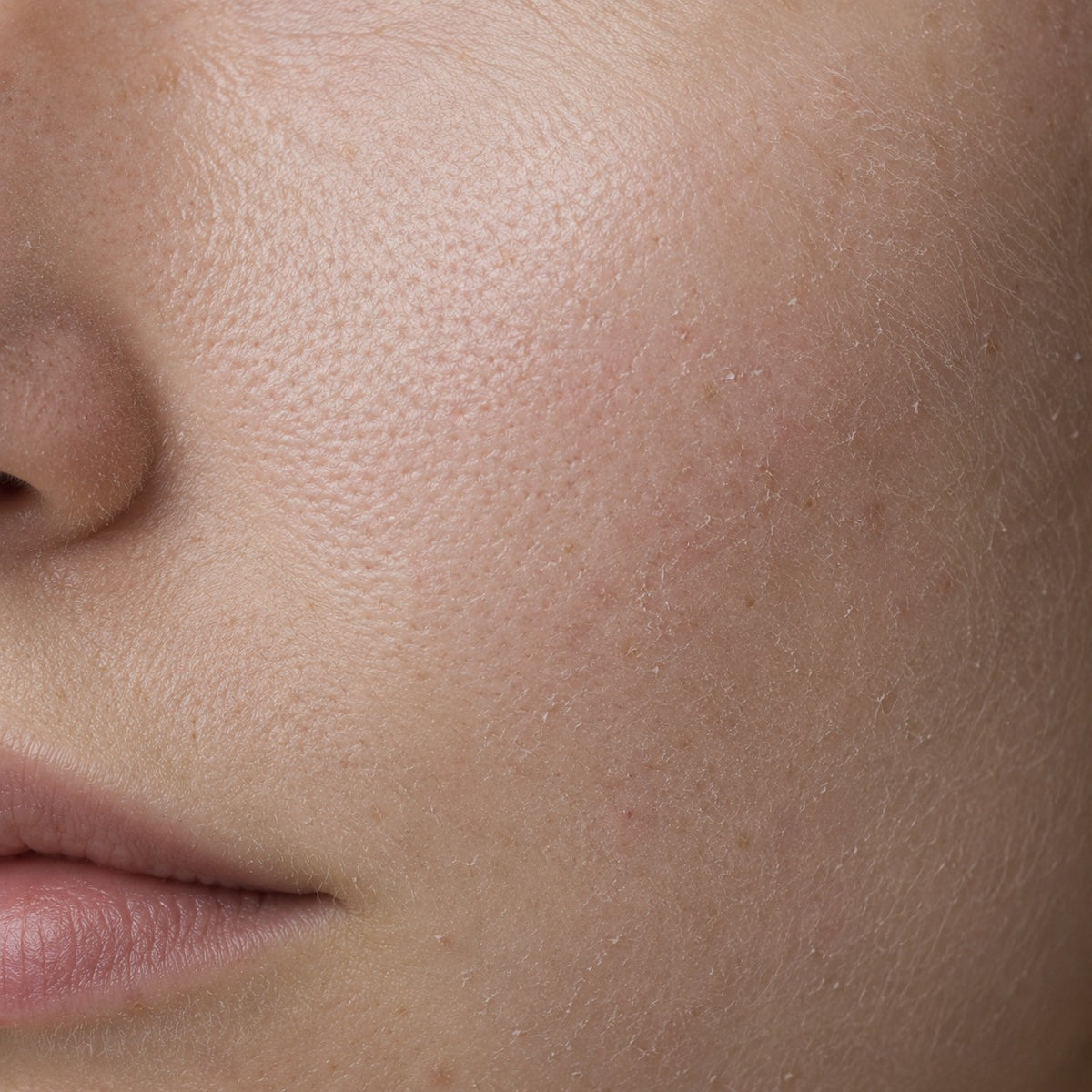 Dry & Dull Skin Solutions
