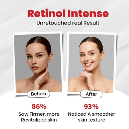 Retinol Intense Cream 0.1% is Your Ultimate Nighttime Skincare Solution ( 40g )